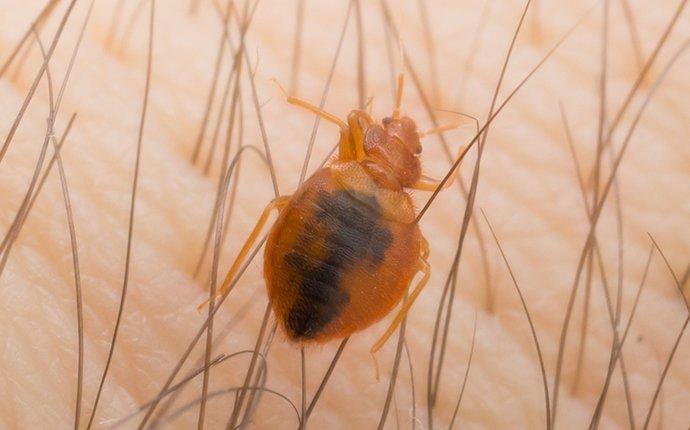 a bed bug in human hair
