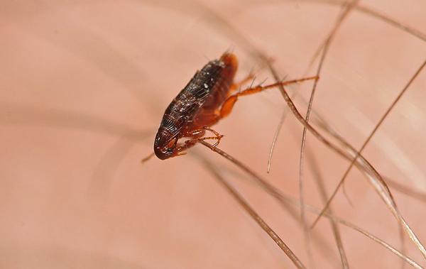 a flea on a human