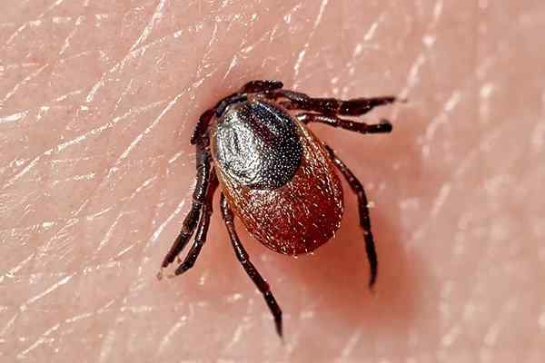 a tick biting skin