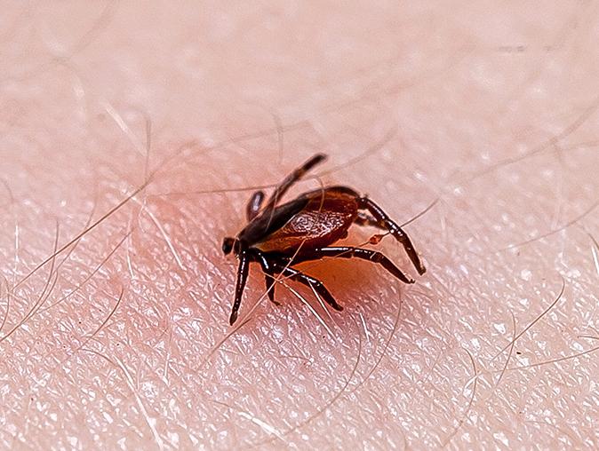 tick embedded on a person's skin