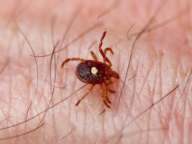 a lone star tick embedded in a new jersey resident