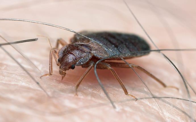 a bed bug biting skin in toppenish washington