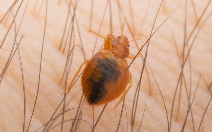 bed bug biting skin