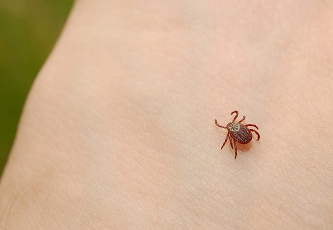 a tick on the skin of a vista new york resident