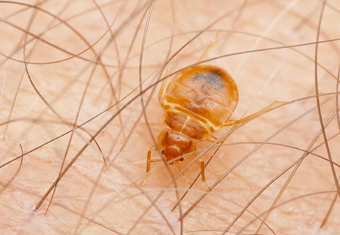a bed bug on a human body