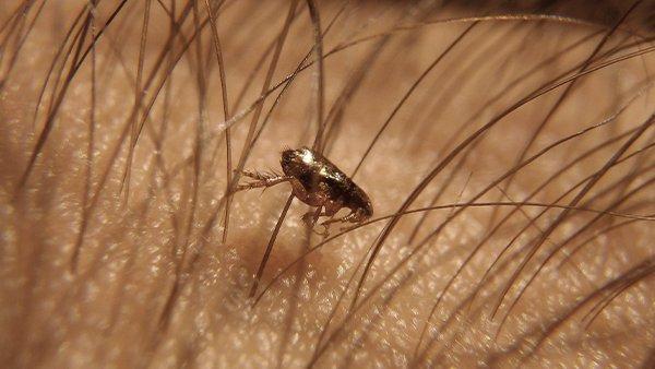 a flea in human hair