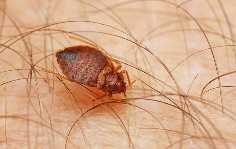 a bed bug crawling on human skin inside of a home in dallas texas